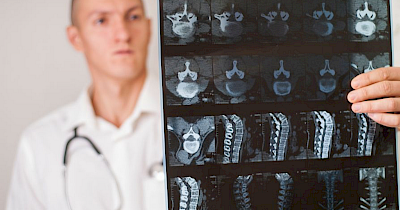 Показання до КТ шийного відділу хребта в Оксфорд Медікал