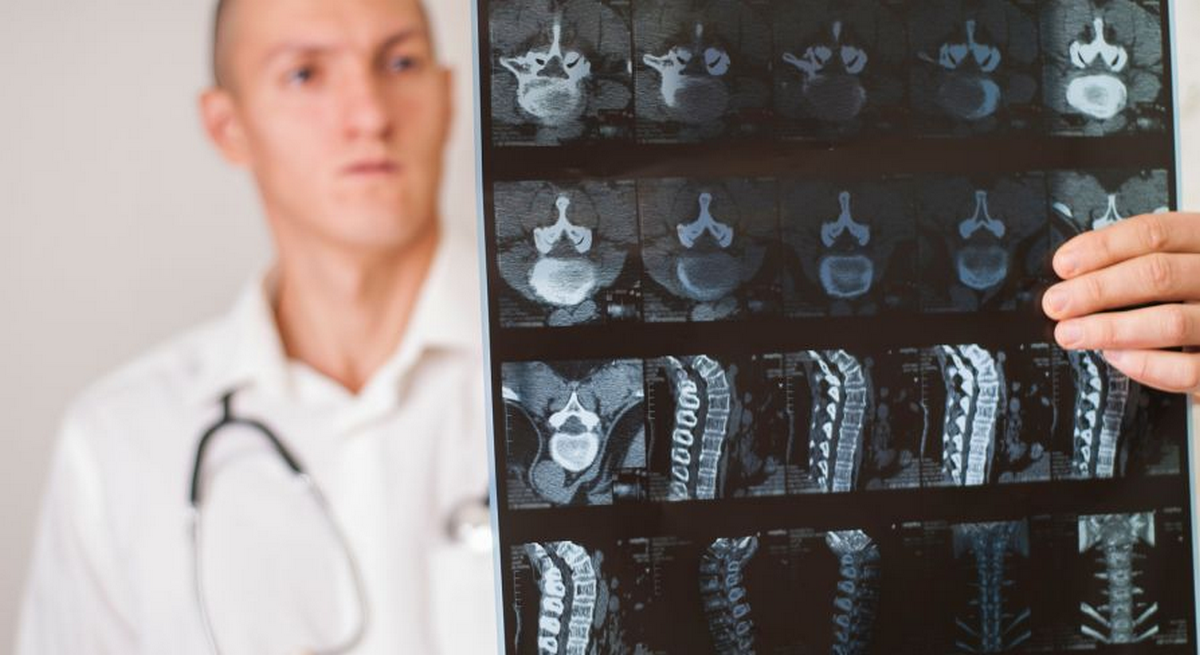 Показання до КТ шийного відділу хребта в Оксфорд Медікал