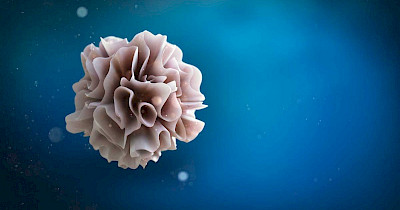 Какие типы рака лечат вакцинами с дендритными клетками